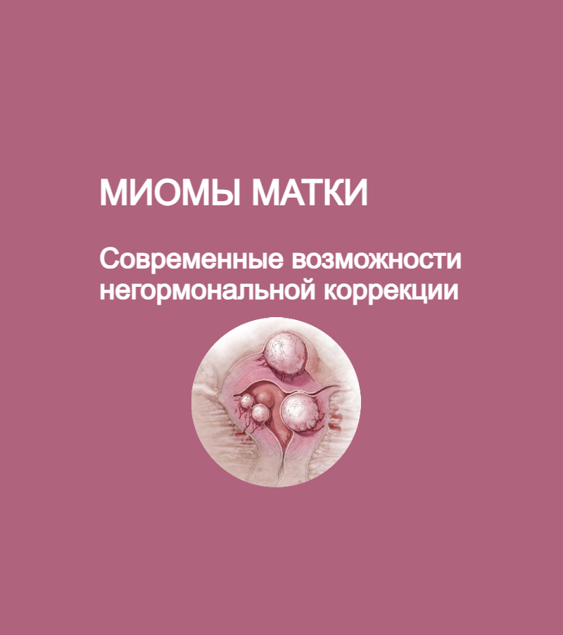 Миомы матки: современные возможности негормональной коррекции