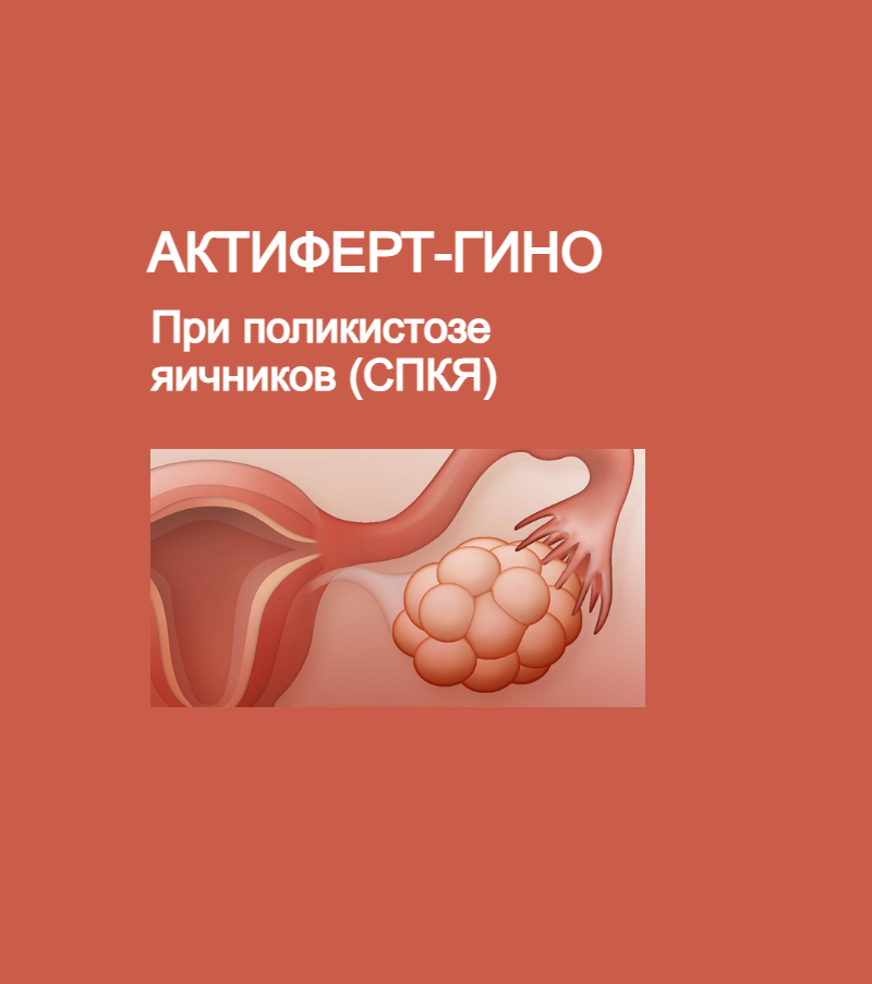 Как работает Актиферт-Гино при синдроме поликистозных яичников (СПКЯ)?