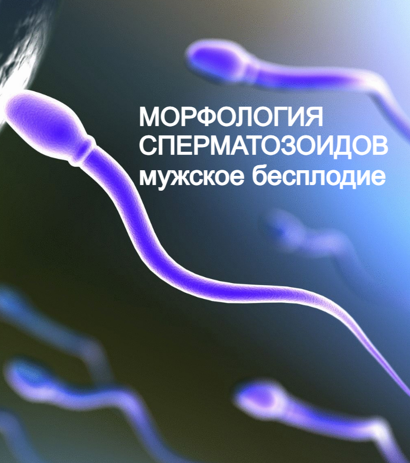 Плохая морфология сперматозоидов как фактор мужского бесплодия (тератозооспермия)